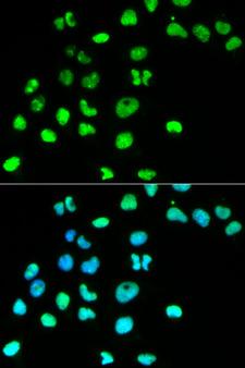 MSH6 Antibody - Immunofluorescence analysis of HeLa cells using MSH6 antibody. Blue: DAPI for nuclear staining.