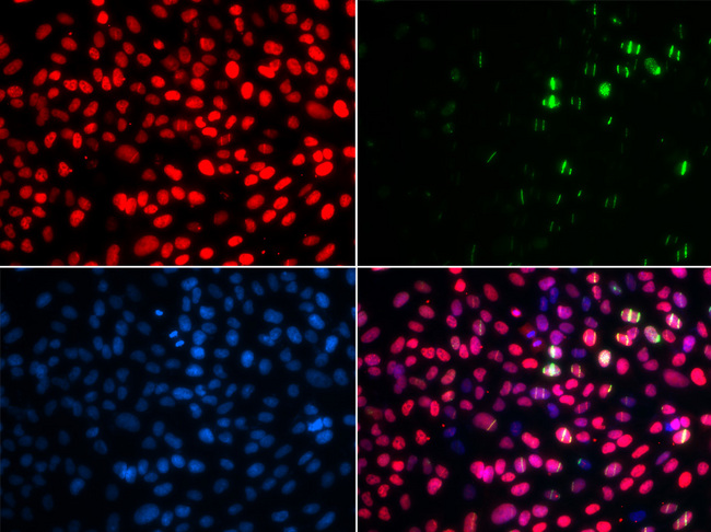 MSH6 Antibody - Immunofluorescence analysis of GFP-RNF168 transgenic U2OS cells using MSH6 antibody. Green:GFP-RNF168 fusion protein expression for DNA damage marker.Blue: DAPI for nuclear staining.RNF168(GFP) can be used to mark cells damaged by UV-A laser for they always gather around DNA damage region.