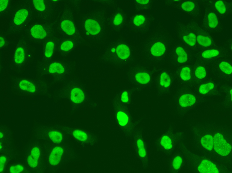MSH6 Antibody - Immunofluorescence analysis of A549 cells using MSH6 antibody.