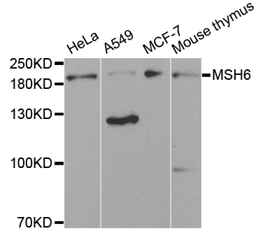 MSH6 Antibody - Western blot analysis of extracts of K562 cell line, using MSH6 antibody.