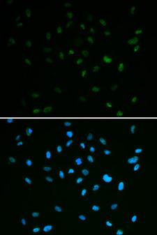 MSH6 Antibody - Immunofluorescence analysis of A549 cell using MSH6 antibody. Blue: DAPI for nuclear staining.
