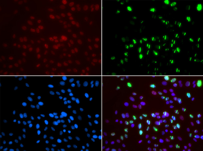 MSH6 Antibody - Immunofluorescence analysis of GFP-RNF168 trangenic U2OS cells.