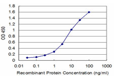 MSI1 / Musashi 1 Antibody - Detection limit for recombinant GST tagged MSI1 is approximately 0.3 ng/ml as a capture antibody.