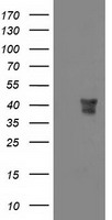 MSI1 / Musashi 1 Antibody - HEK293T cells were transfected with the pCMV6-ENTRY control (Left lane) or pCMV6-ENTRY MSI1 (Right lane) cDNA for 48 hrs and lysed. Equivalent amounts of cell lysates (5 ug per lane) were separated by SDS-PAGE and immunoblotted with anti-MSI1.