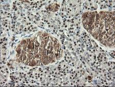 MSI1 / Musashi 1 Antibody - IHC of paraffin-embedded Human pancreas tissue using anti-MSI1 mouse monoclonal antibody.