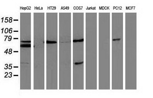 MSI1 / Musashi 1 Antibody - Western blot of extracts (35ug) from 9 different cell lines by using anti-MSI1 monoclonal antibody.