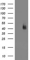 MSI1 / Musashi 1 Antibody - HEK293T cells were transfected with the pCMV6-ENTRY control (Left lane) or pCMV6-ENTRY MSI1 (Right lane) cDNA for 48 hrs and lysed. Equivalent amounts of cell lysates (5 ug per lane) were separated by SDS-PAGE and immunoblotted with anti-MSI1.