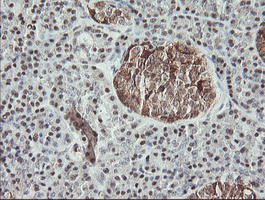 MSI1 / Musashi 1 Antibody - IHC of paraffin-embedded Human pancreas tissue using anti-MSI1 mouse monoclonal antibody. (Heat-induced epitope retrieval by 10mM citric buffer, pH6.0, 100C for 10min).