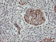 MSI1 / Musashi 1 Antibody - IHC of paraffin-embedded Human pancreas tissue using anti-MSI1 mouse monoclonal antibody. (Heat-induced epitope retrieval by 10mM citric buffer, pH6.0, 100C for 10min).