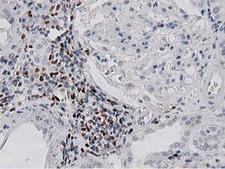 MSI1 / Musashi 1 Antibody - IHC of paraffin-embedded Human Kidney tissue using anti-MSI1 mouse monoclonal antibody. (Heat-induced epitope retrieval by 10mM citric buffer, pH6.0, 100C for 10min).