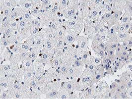 MSI1 / Musashi 1 Antibody - IHC of paraffin-embedded Human liver tissue using anti-MSI1 mouse monoclonal antibody. (Heat-induced epitope retrieval by 10mM citric buffer, pH6.0, 100C for 10min).