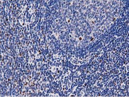 MSI1 / Musashi 1 Antibody - IHC of paraffin-embedded Human lymph node tissue using anti-MSI1 mouse monoclonal antibody. (Heat-induced epitope retrieval by 10mM citric buffer, pH6.0, 100C for 10min).