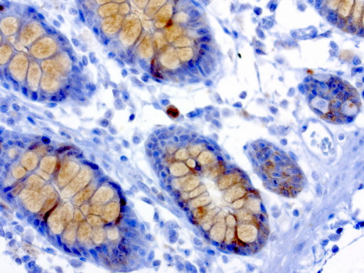 MSI1 / Musashi 1 Antibody - Immunohistochemical staining of paraffin-embedded human colon using anti-MSI1 clone UMAB127 mouse monoclonal antibody at 1:200 dilution 1mg/mL and detection with Polink2 Broad HRP DAB.requires heat-induced epitope retrieval with Accel pH 8.7 in a presure cooker for 3 minutes at 110C.