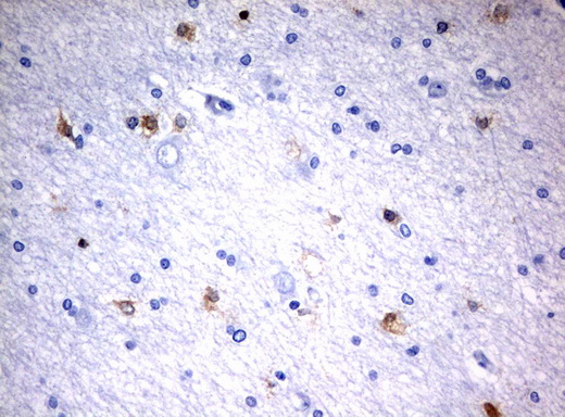 MSI1 / Musashi 1 Antibody - Immunohistochemical staining of paraffin-embedded Human adult brain tissue using anti-MSI1 mouse monoclonal antibody.  heat-induced epitope retrieval by 10mM citric buffer, pH6.0, 120C for 3min)