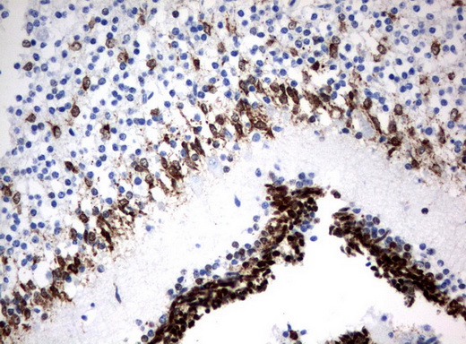 MSI1 / Musashi 1 Antibody - Immunohistochemical staining of paraffin-embedded Human embryonic cerebellum using anti-MSI1 mouse monoclonal antibody.  heat-induced epitope retrieval by 10mM citric buffer, pH6.0, 120C for 3min)