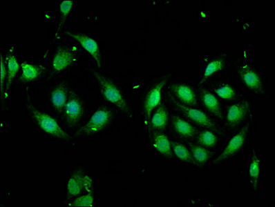 MSI1 / Musashi 1 Antibody - Immunofluorescence staining of A549 cells at a dilution of 1:166, counter-stained with DAPI. The cells were fixed in 4% formaldehyde, permeabilized using 0.2% Triton X-100 and blocked in 10% normal Goat Serum. The cells were then incubated with the antibody overnight at 4 °C.The secondary antibody was Alexa Fluor 488-congugated AffiniPure Goat Anti-Rabbit IgG (H+L) .