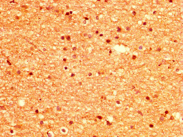 MSI1 / Musashi 1 Antibody - Immunohistochemistry image at a dilution of 1:500 and staining in paraffin-embedded human brain tissue performed on a Leica BondTM system. After dewaxing and hydration, antigen retrieval was mediated by high pressure in a citrate buffer (pH 6.0) . Section was blocked with 10% normal goat serum 30min at RT. Then primary antibody (1% BSA) was incubated at 4 °C overnight. The primary is detected by a biotinylated secondary antibody and visualized using an HRP conjugated SP system.