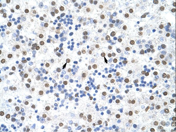 MSI2 Antibody - MSI2 antibody ARP41112_T100-NP_620412-MSI2 (musashi homolog 2 (Drosophila)) Antibody was used in IHC to stain formalin-fixed, paraffin-embedded human liver.  This image was taken for the unconjugated form of this product. Other forms have not been tested.