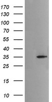 MSI2 Antibody - HEK293T cells were transfected with the pCMV6-ENTRY control (Left lane) or pCMV6-ENTRY MSI2 (Right lane) cDNA for 48 hrs and lysed. Equivalent amounts of cell lysates (5 ug per lane) were separated by SDS-PAGE and immunoblotted with anti-MSI2.