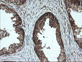 MSI2 Antibody - IHC of paraffin-embedded Human prostate tissue using anti-MSI2 mouse monoclonal antibody.