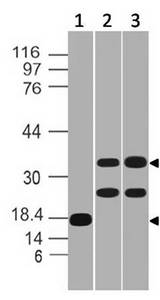 MSI2 Antibody - Fig-3: Western blot analysis of MSI-2. Anti Msi-2 was used at 0.5 µg/ml in Recombinant and 2 µg/ml in SKBR3, MCF7 Lysates.