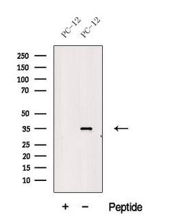 MSI2 Antibody - Western blot analysis of extracts of PC-12 cells using MSI2H antibody. The lane on the left was treated with blocking peptide.