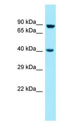 MSL1 Antibody - MSL1 antibody Western Blot of 721_B.  This image was taken for the unconjugated form of this product. Other forms have not been tested.