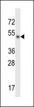 MSL1 Antibody - MSL1 Antibody western blot of HeLa cell line lysates (35 ug/lane). The MSL1 antibody detected the MSL1 protein (arrow).