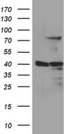 MSL2 Antibody - HEK293T cells were transfected with the pCMV6-ENTRY control. (Left lane) or pCMV6-ENTRY MSL2. (Right lane) cDNA for 48 hrs and lysed. Equivalent amounts of cell lysates. (5 ug per lane) were separated by SDS-PAGE and immunoblotted with anti-MSL2. (1:2000)