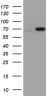 MSL2 Antibody - HEK293T cells were transfected with the pCMV6-ENTRY control. (Left lane) or pCMV6-ENTRY MSL2. (Right lane) cDNA for 48 hrs and lysed. Equivalent amounts of cell lysates. (5 ug per lane) were separated by SDS-PAGE and immunoblotted with anti-MSL2. (1:2000)