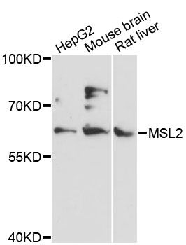 MSL2 Antibody - Western blot analysis of extracts of various cell lines, using MSL2 antibody at 1:3000 dilution. The secondary antibody used was an HRP Goat Anti-Rabbit IgG (H+L) at 1:10000 dilution. Lysates were loaded 25ug per lane and 3% nonfat dry milk in TBST was used for blocking. An ECL Kit was used for detection and the exposure time was 10s.