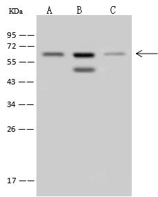 MSL2 Antibody - Anti-MSL2 rabbit polyclonal antibody at 1:500 dilution. Lane A: 293T Whole Cell Lysate. Lane B: HeLa Whole Cell Lysate. Lane C: U-251 MG Whole Cell Lysate. Lysates/proteins at 30 ug per lane. Secondary: Goat Anti-Rabbit IgG (H+L)/HRP at 1/10000 dilution. Developed using the ECL technique. Performed under reducing conditions. Predicted band size: 62 kDa. Observed band size: 62 kDa.