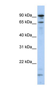 MSL2 Antibody - MSL2 / MSL2L1 antibody Western blot of HeLa lysate. This image was taken for the unconjugated form of this product. Other forms have not been tested.