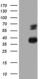 MSLN / Mesothelin Antibody - HEK293T cells were transfected with the pCMV6-ENTRY control (Left lane) or pCMV6-ENTRY MSLN (Right lane) cDNA for 48 hrs and lysed. Equivalent amounts of cell lysates (5 ug per lane) were separated by SDS-PAGE and immunoblotted with anti-MSLN.
