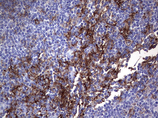 MSLN / Mesothelin Antibody - IHC of paraffin-embedded Human tonsil using anti-MSLN mouse monoclonal antibody. (Heat-induced epitope retrieval by 1 mM EDTA in 10mM Tris, pH8.5, 120°C for 3min).