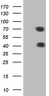 MSLN / Mesothelin Antibody - HEK293T cells were transfected with the pCMV6-ENTRY control. (Left lane) or pCMV6-ENTRY MSLN. (Right lane) cDNA for 48 hrs and lysed. Equivalent amounts of cell lysates. (5 ug per lane) were separated by SDS-PAGE and immunoblotted with anti-MSLN.