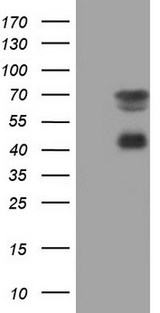 MSLN / Mesothelin Antibody - HEK293T cells were transfected with the pCMV6-ENTRY control. (Left lane) or pCMV6-ENTRY MSLN. (Right lane) cDNA for 48 hrs and lysed