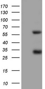MSLN / Mesothelin Antibody - HEK293T cells were transfected with the pCMV6-ENTRY control. (Left lane) or pCMV6-ENTRY MSLN. (Right lane) cDNA for 48 hrs and lysed. Equivalent amounts of cell lysates. (5 ug per lane) were separated by SDS-PAGE and immunoblotted with anti-MSLN.