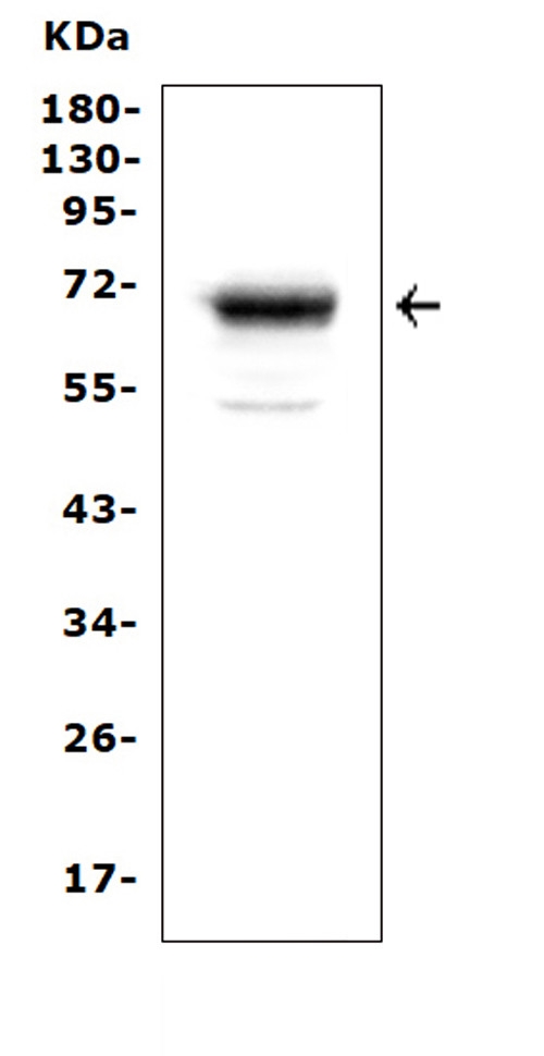 MSLN / Mesothelin Antibody - Western blot analysis of Mesothelin using anti-Mesothelin antibody. Electrophoresis was performed on a 5-20% SDS-PAGE gel at 70V (Stacking gel) / 90V (Resolving gel) for 2-3 hours. The sample well of each lane was loaded with 50ug of sample under reducing conditions. Lane 1: human Hela whole cell lysates, After Electrophoresis, proteins were transferred to a Nitrocellulose membrane at 150mA for 50-90 minutes. Blocked the membrane with 5% Non-fat Milk/ TBS for 1.5 hour at RT. The membrane was incubated with rabbit anti-Mesothelin antigen affinity purified polyclonal antibody at 0.5 µg/mL overnight at 4°C, then washed with TBS-0.1% Tween 3 times with 5 minutes each and probed with a goat anti-rabbit IgG-HRP secondary antibody at a dilution of 1:10000 for 1.5 hour at RT. The signal is developed using an Enhanced Chemiluminescent detection (ECL) kit with Tanon 5200 system. A specific band was detected for Mesothelin at approximately 69KD. The expected band size for Mesothelin is at 69KD.