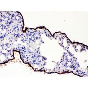 MSLN / Mesothelin Antibody - Mesothelin antibody IHC-paraffin. IHC(P): Mouse Lung Tissue.