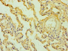 MSLN / Mesothelin Antibody - Immunohistochemistry of paraffin-embedded human lung tissue using antibody at 1:100 dilution.