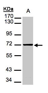 MSLN / Mesothelin Antibody - Sample (30 ug of whole cell lysate). A:293T. 7.5% SDS PAGE. Mesothelin antibody diluted at 1:1000