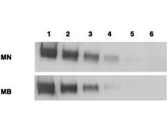 MSLN / Mesothelin Antibody - Anti-Mesothelin Antibodies - Western Blot. Western blotting using anti-mesothelin antibodies to detect mesothelin-Fc at 100 ng (lane 1), 25 ng (lane 2), 6 ng (lane 3), 2 ng (lane 4) and 0.4 ng (lane 5). Lane 6 contains 50 ng of CDC25-Fc. Proteins were separated on 4-20% gradient gel by SDS-PAGE followed by transfer to PVDF membrane. Primary antibody was used at 1 ug/ml followed by reaction with ALP goat anti-mouse IgG and BCIP/NBT substrate. Reprinted with permission from Clin. Cancer Res. 11(16):5840-6.