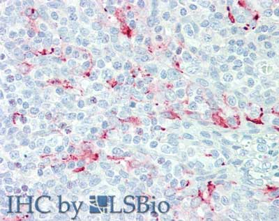 MSLN / Mesothelin Antibody - Immunohistochemistry of Mouse anti-Mesothelin antibody. Tissue: tonsil. Fixation: formalin fixed paraffin embedded. Antigen retrieval: not required. Primary antibody: anti-Mesothelin antibody at 15 µg/mL for 1 h at RT. Secondary antibody: Peroxidase mouse secondary antibody at 1:10,000 for 45 min at RT. Staining: Mesothelin as precipitated red signal with hematoxylin purple nuclear counterstain.