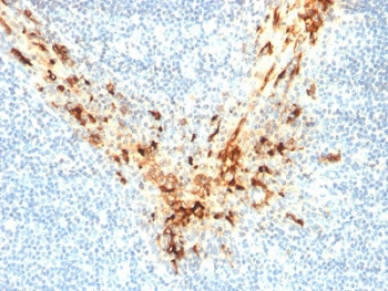 MSLN / Mesothelin Antibody - IHC testing of FFPE human tonsil with Mesothelin antibody (clone MSLN/2131). HIER: boil tissue sections in pH6, 10mM citrate buffer, for 10-20 min followed by cooling at RT for 20 min.