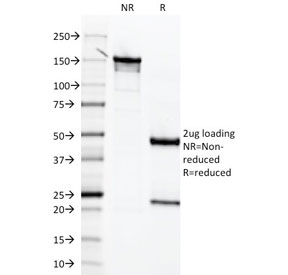 MSLN / Mesothelin Antibody - SDS-PAGE analysis of purified, BSA-free Mesothelin antibody (clone MSLN/2131) as confirmation of integrity and purity.