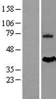 MSLN / Mesothelin Protein - Western validation with an anti-DDK antibody * L: Control HEK293 lysate R: Over-expression lysate