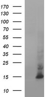 MSMB / MSP Antibody - HEK293T cells were transfected with the pCMV6-ENTRY control (Left lane) or pCMV6-ENTRY MSMB (Right lane) cDNA for 48 hrs and lysed. Equivalent amounts of cell lysates (5 ug per lane) were separated by SDS-PAGE and immunoblotted with anti-MSMB.