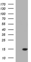 MSMB / MSP Antibody - HEK293T cells were transfected with the pCMV6-ENTRY control (Left lane) or pCMV6-ENTRY MSMB (Right lane) cDNA for 48 hrs and lysed. Equivalent amounts of cell lysates (5 ug per lane) were separated by SDS-PAGE and immunoblotted with anti-MSMB.