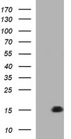 MSMB / MSP Antibody - HEK293T cells were transfected with the pCMV6-ENTRY control (Left lane) or pCMV6-ENTRY MSMB (Right lane) cDNA for 48 hrs and lysed. Equivalent amounts of cell lysates (5 ug per lane) were separated by SDS-PAGE and immunoblotted with anti-MSMB.